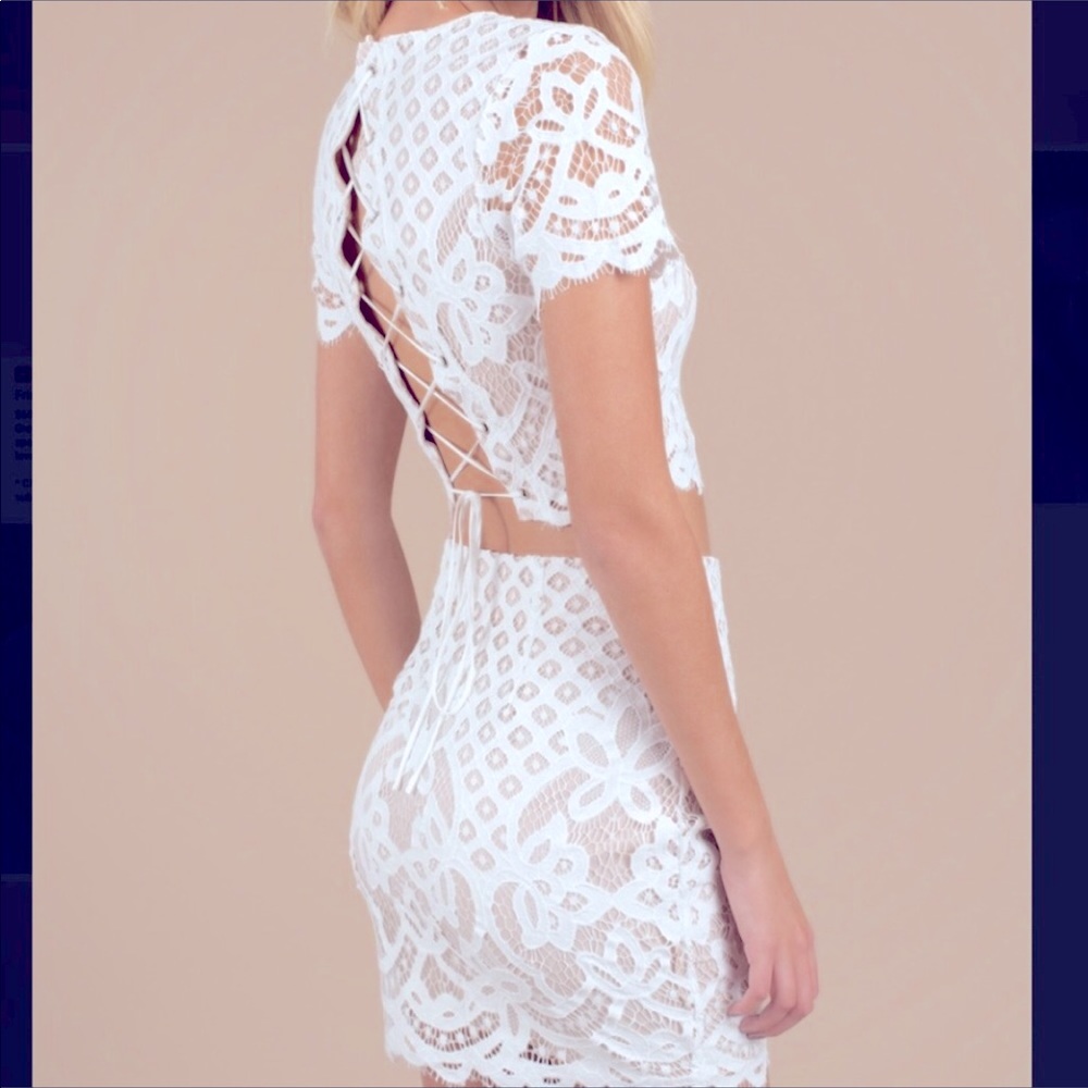 Tobi White Lace Set